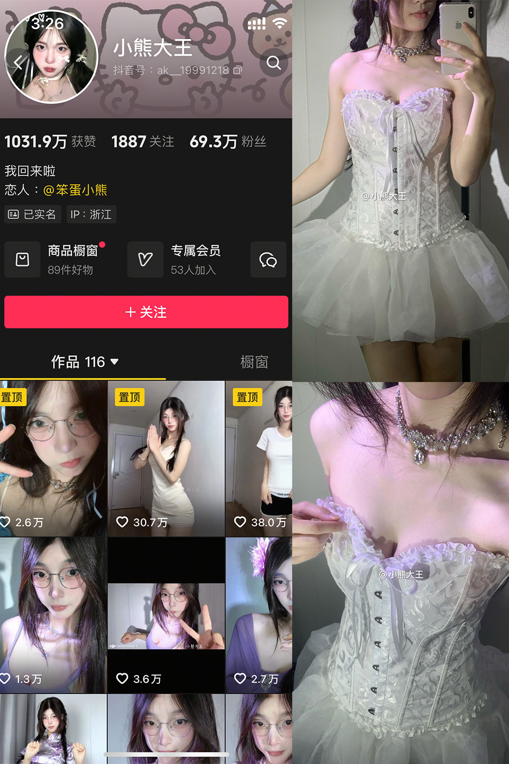 抖音 小熊大王 微密圈 001期 【32P】-樱桃熟了