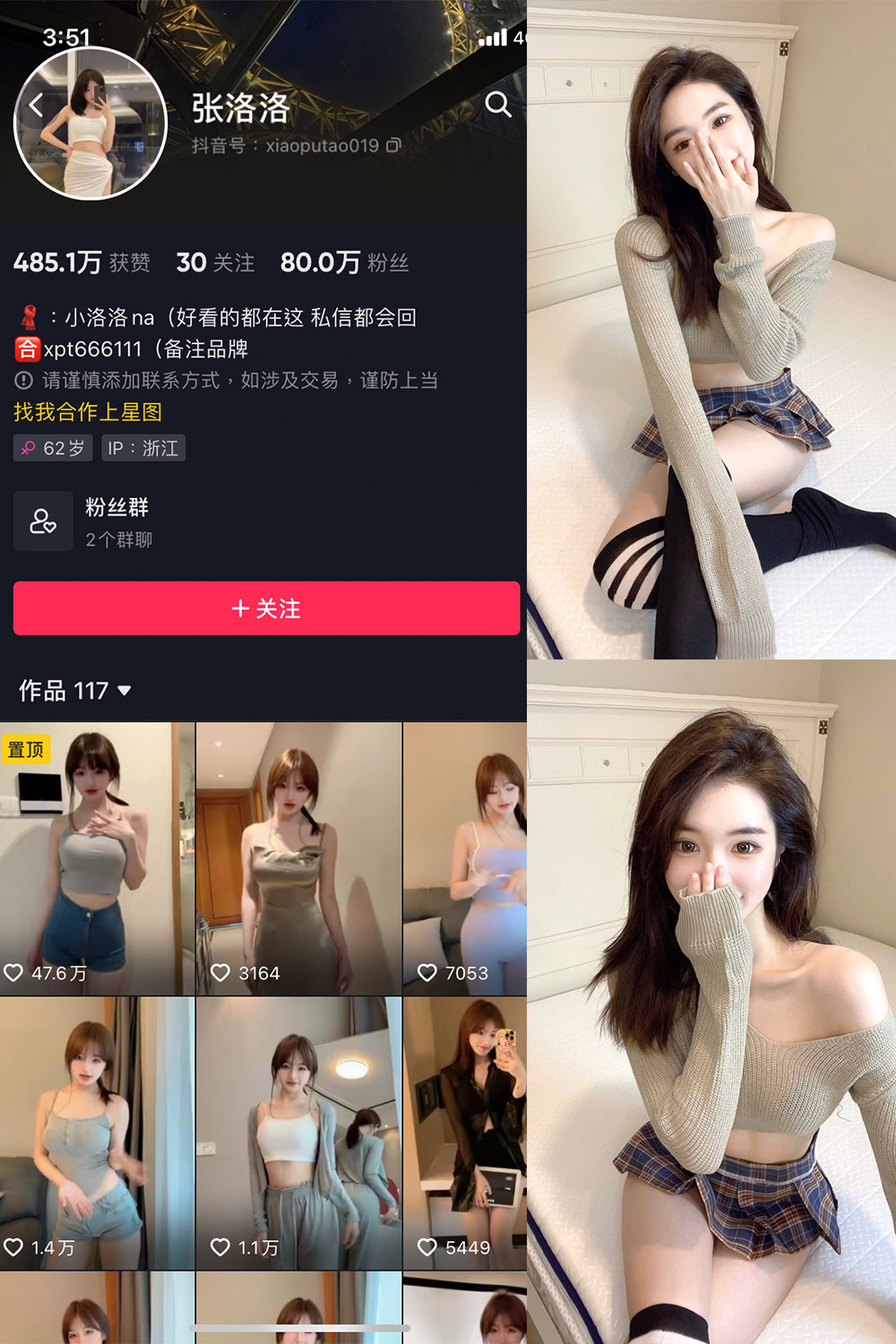 抖音 张洛洛 微密圈 NO.002期 【27P】-樱桃熟了